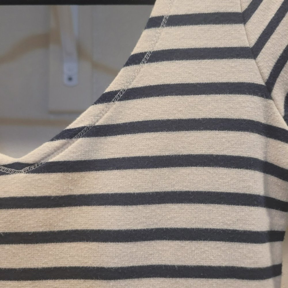 Abercrombie & Fitch Striped Dress